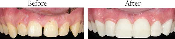 dental images 17701